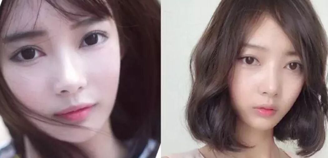 摘下眼镜就感觉双目无神,担心眼睛失明