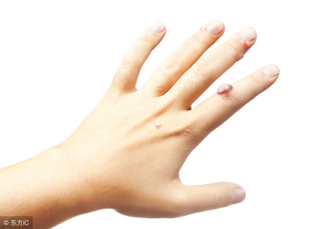 肛门瘙痒出血是什么原因,成年人的肛门瘙痒是什么原因