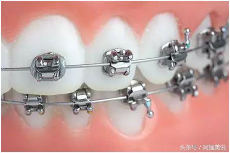 从3分到10分中间需要几分钟,从3分到4分付出了多大努力