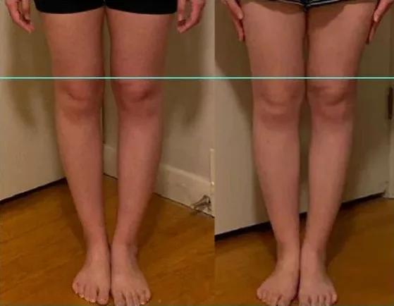 六种好看腿型,几种好看的腿型