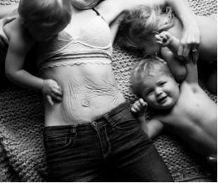 孕妇油预防妊娠纹,孕妇怎样预防妊娠纹抹什么