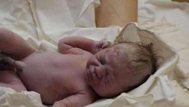 顺产与剖腹产的深度对比分析,顺产与剖宫产对比