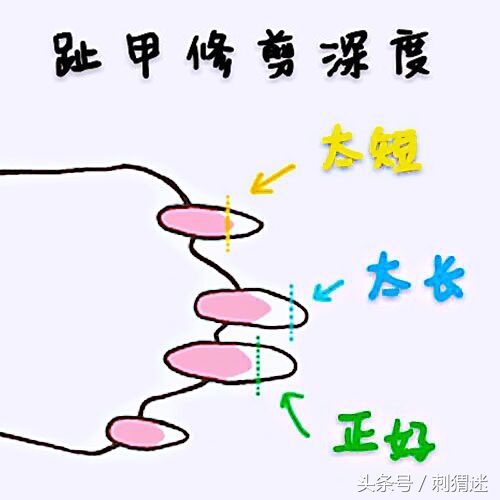 如何给刺猬剃毛,怎么给刺猬剪毛发