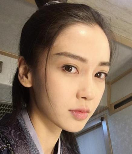 高圆圆戴牙套前后对比,高圆圆牙齿矫正牙套戴了几年