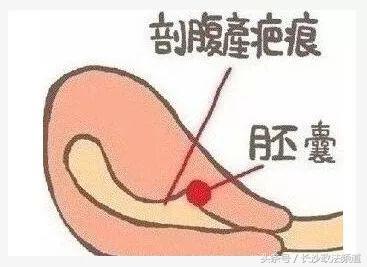 晴天霹雳一个女孩降生,女子产下双胞胎20年后发现蹊跷