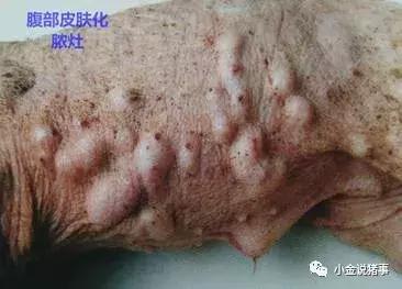 脓包型痤疮怎么治疗,脓包的最佳治疗方法