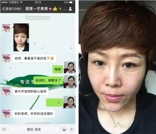 激素药造成皮肤发红能自愈吗,激素停药以后皮肤变得敏感潮红