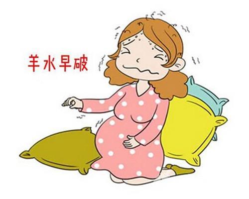 临近产期,肚子疼就是要生了吗?那些你不知道的产兆