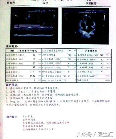 高龄心衰患者怎么做降压治疗?