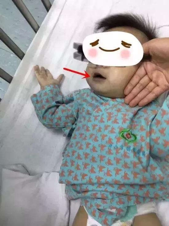 无知家长给孩子生吃蝌蚪,幼童被喂活蝌蚪民间偏方不可取