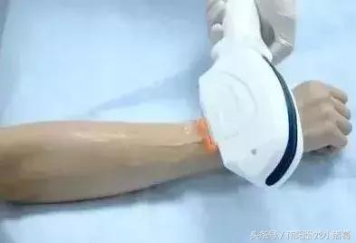 南阳时光整形医院脱唇毛,南阳脱毛注意什么