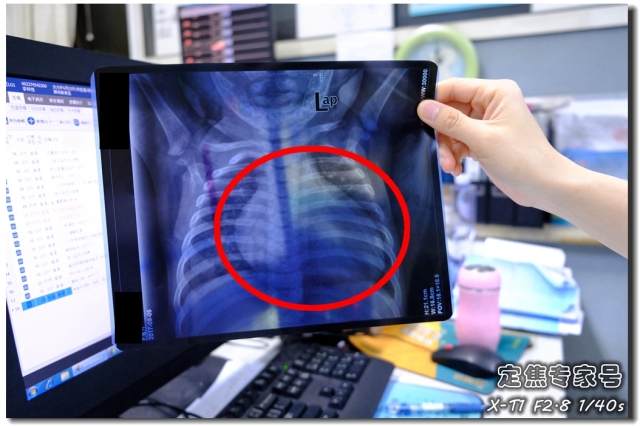 掌纹非常清晰还有很多小掌纹,掌纹突然出现大凶掌纹啥样