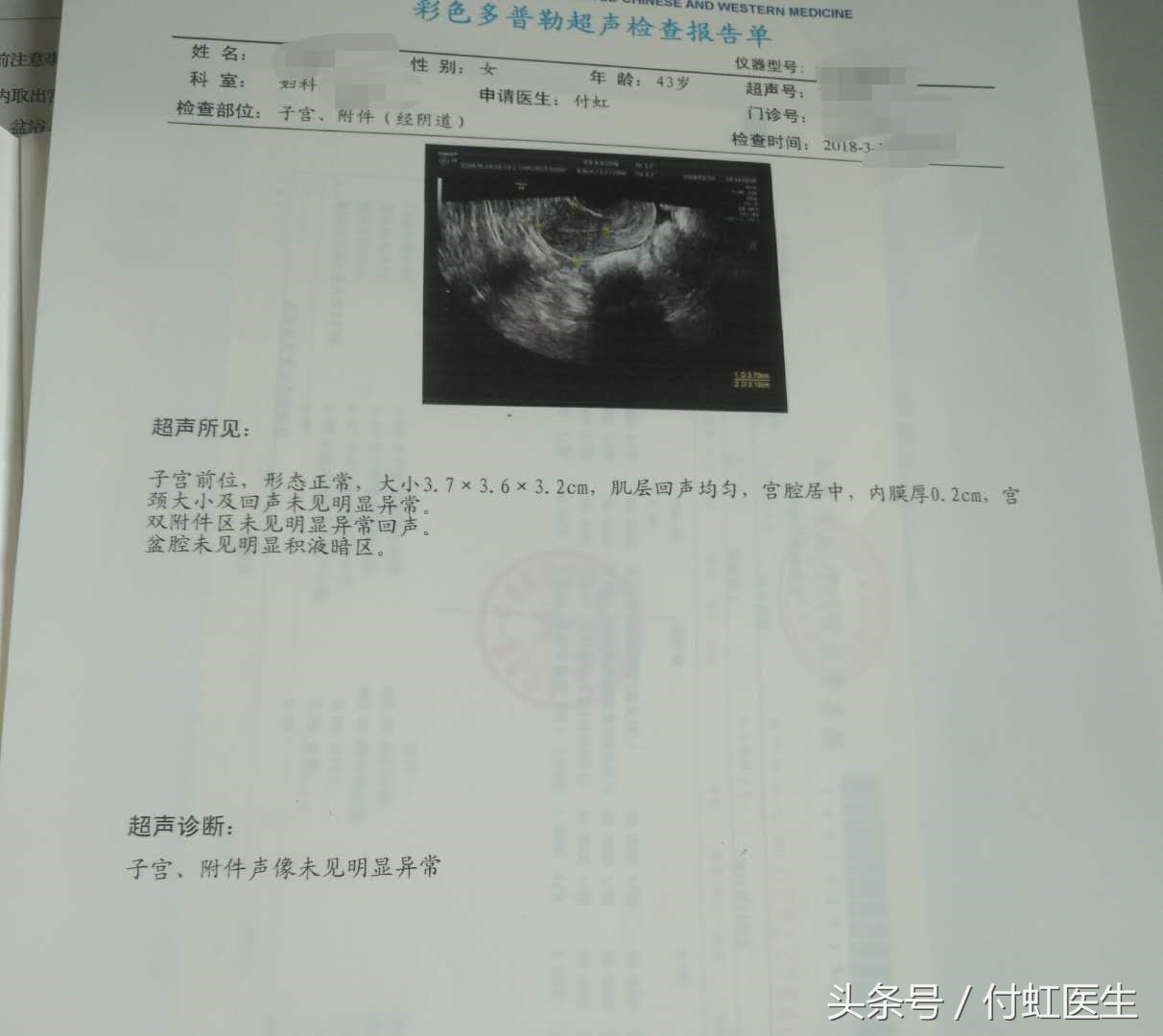 我已经半年没来例假了是绝经了吗,两个月没来例假原来是绝经了