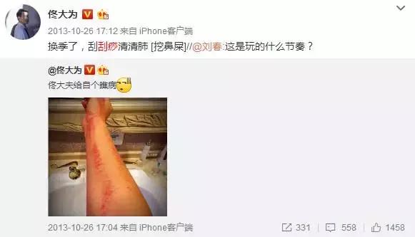 触目惊心！杨丞琳阿娇等人把刮痧过度神话，专家打脸：根本没效果