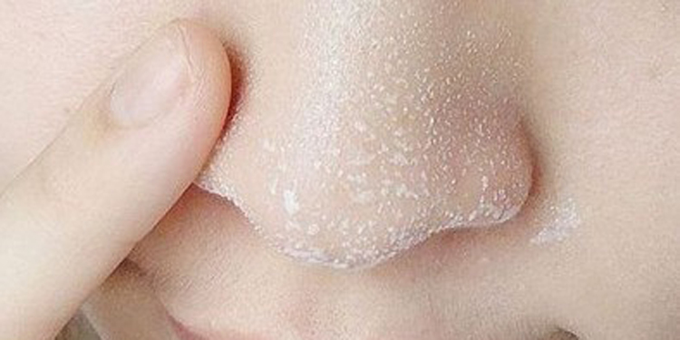 洗澡会让皮肤干燥吗,洗澡多了会对皮肤造成怎样的影响