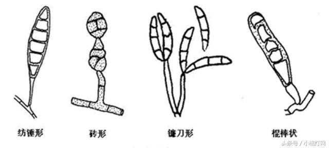 真菌微生物国标检测方法,微生物真菌检验