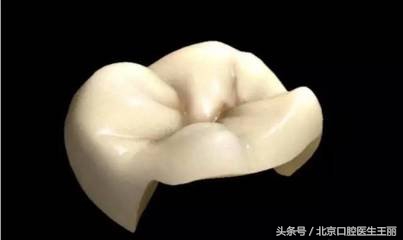 医生根管治疗后做牙套吗,医生让做根管治疗靠谱吗