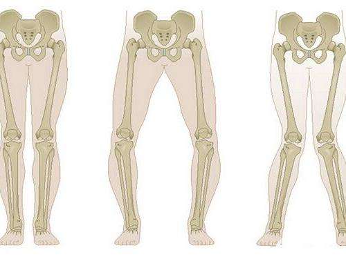 2岁宝宝走路内八字和什么有关,两岁宝宝走路有点内八字怎么矫正