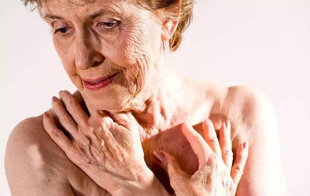 皮肤瘙痒这些方法一定要知道！