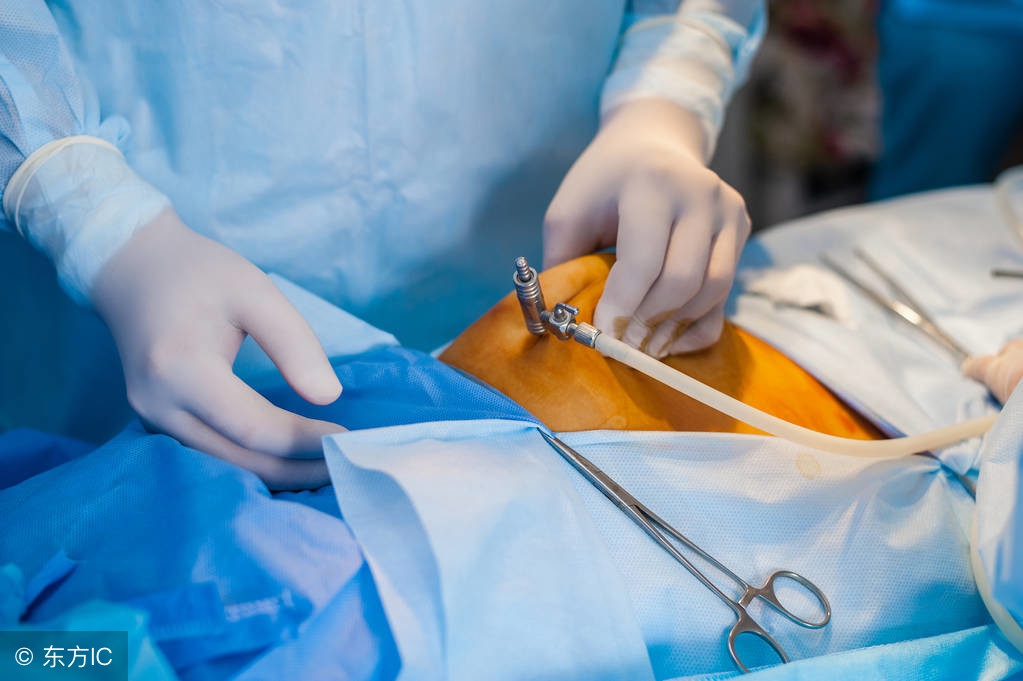 清远医疗纠纷律师咨询在线解答,清远医疗纠纷律师咨询