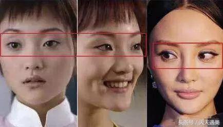 大方承认割双眼皮的明星,戚薇旗下明星