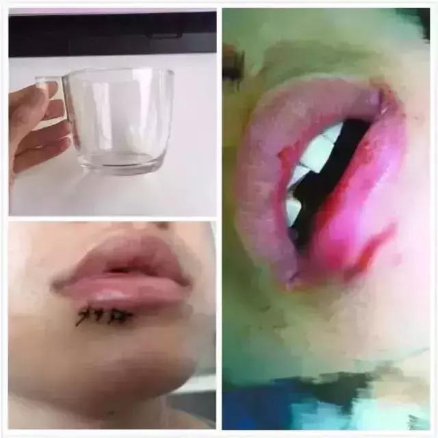 宜家水杯爆炸赔偿多少钱,宜家水杯自爆案最终结果