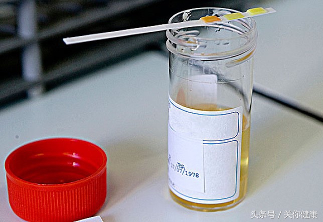 健康尿液的特征,健康检测小便