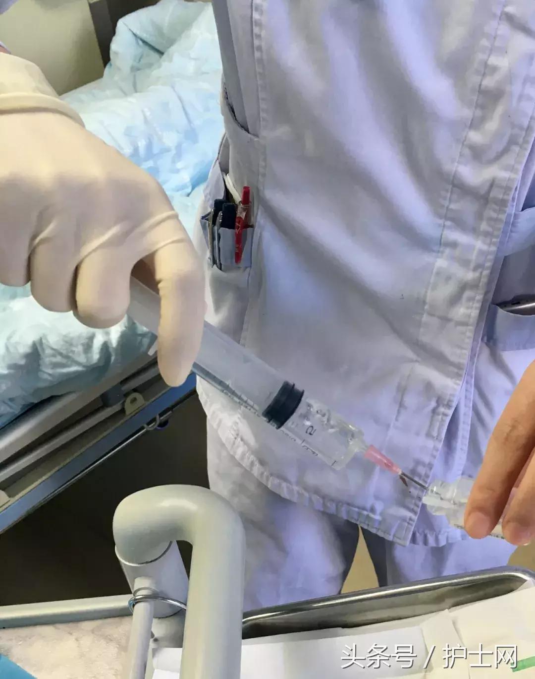 输液港扎针最全示范,输液港拔针的正确方法视频教程