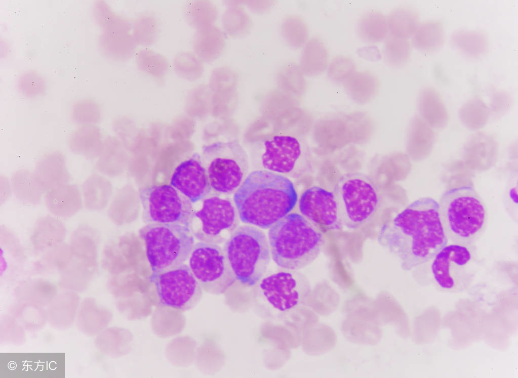 小孩子血小板低的原因及危害,红细胞血小板低的原因及危害