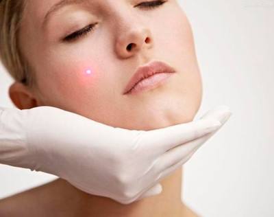 对于激光祛斑，你又了解多少？