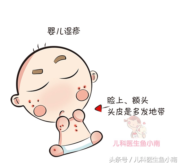 宝宝湿疹热疹区别,宝宝湿疹和热疹怎么观察