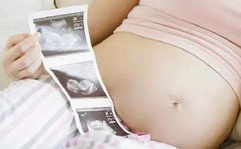 说个羞羞的事，顺产会影响日后同房吗？