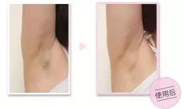 宫颈癌女性死前会有预感吗,平均两分钟有几个人死于宫颈癌