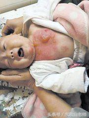 「家政学堂」新生儿烫伤防范与紧急处理