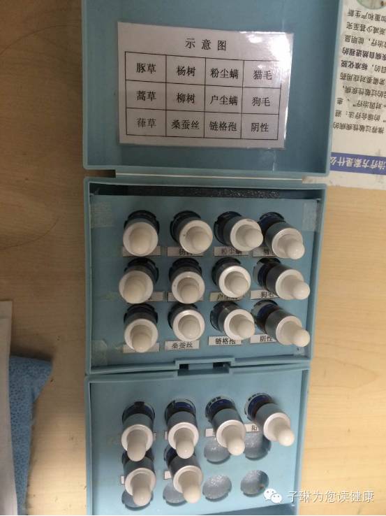 过敏性鼻炎像得了不治之症,过敏性鼻炎是不是什么大病