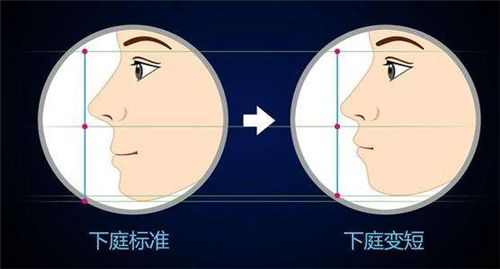 阿娇整牙,阿娇整牙前后对比