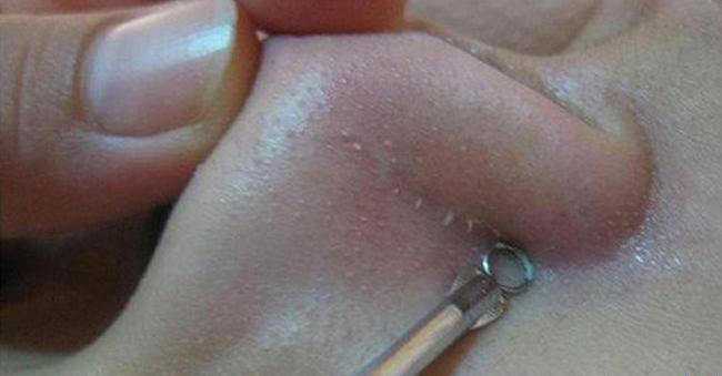 去黑头草莓鼻最有效的方法,怎么去黑头不会变草莓鼻