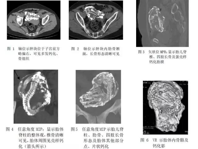 鐭宠儙妗堜緥璁板綍,鐭宠儙姘戦棿鏁呬簨