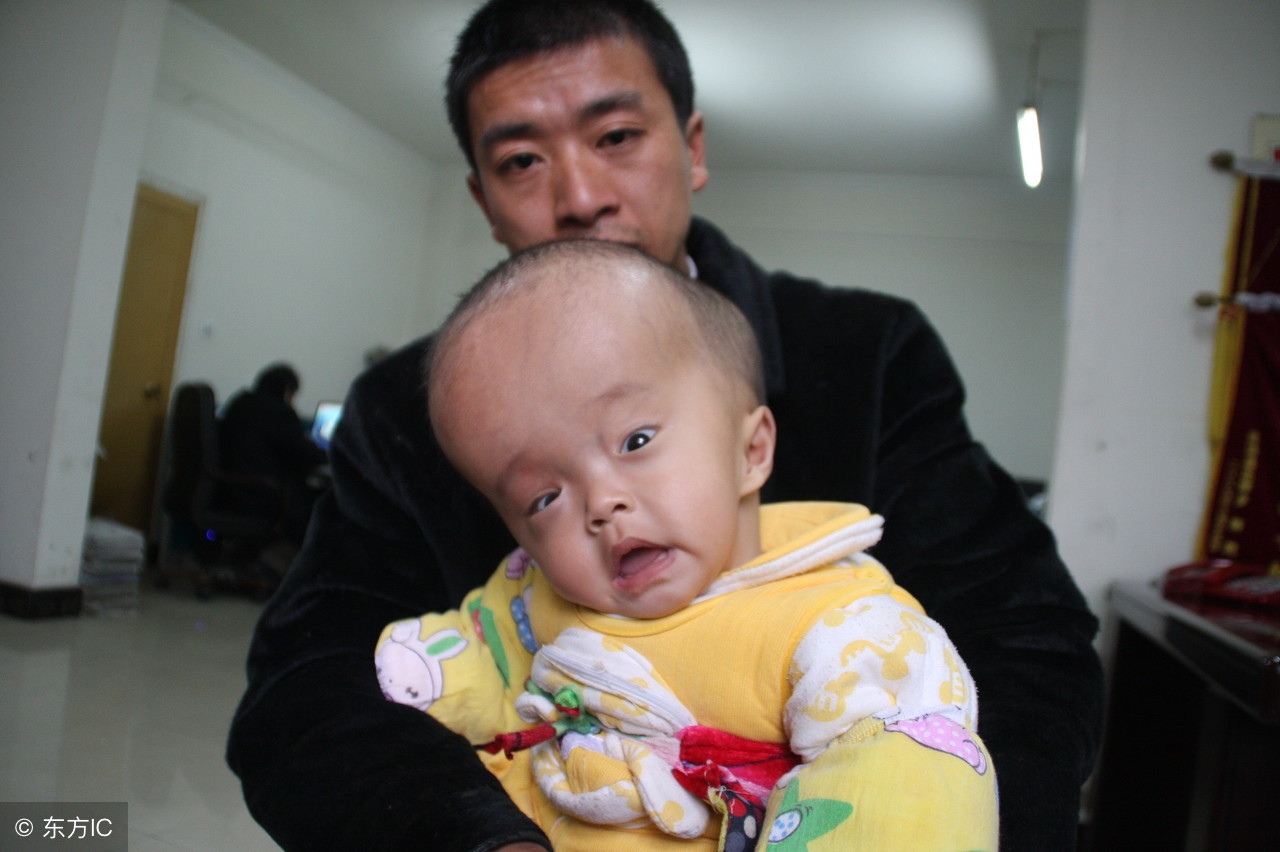 交通性脑积水，防重于治！要防范于未然就得知其根本