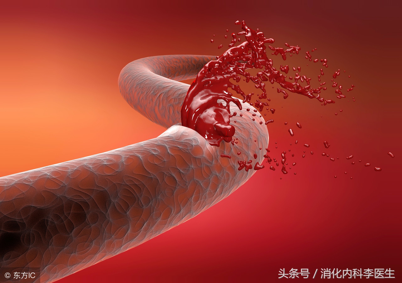 胃溃疡和十二指肠溃疡的主要区别,胃溃疡跟十二指肠溃疡的疼痛区别