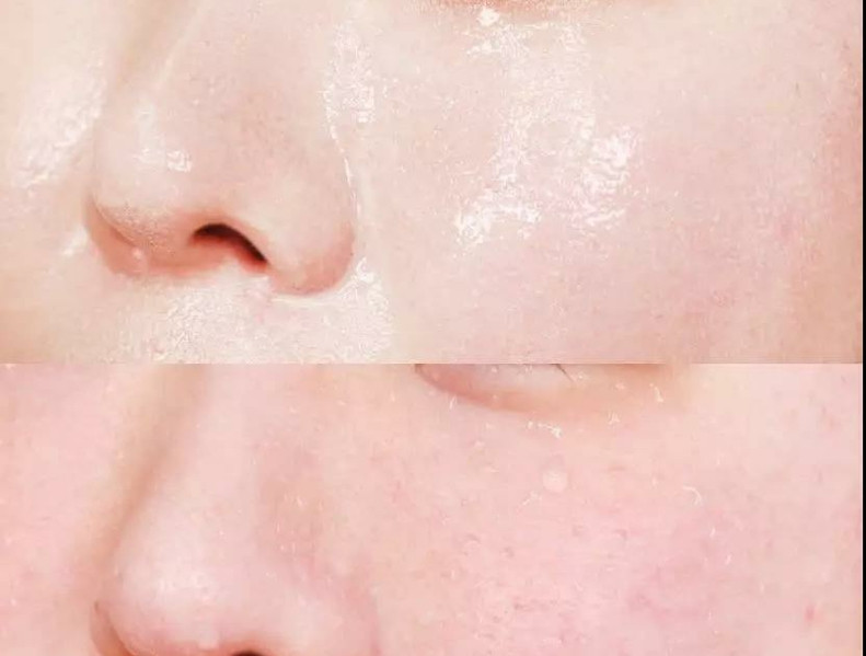 怎样卸妆最干净不伤皮肤,混合性皮肤适合用什么卸妆产品