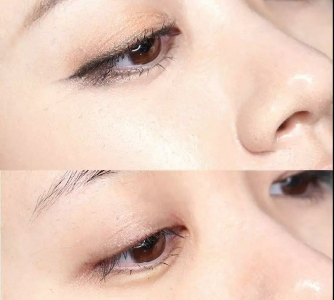 怎样卸妆最干净不伤皮肤,混合性皮肤适合用什么卸妆产品