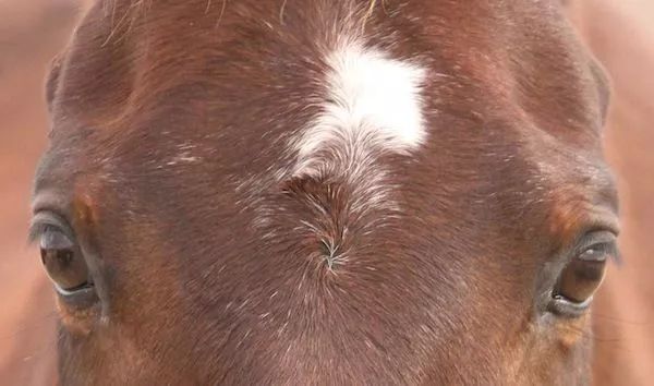 为什么头顶上有发旋,脑袋上有旋是怎么回事