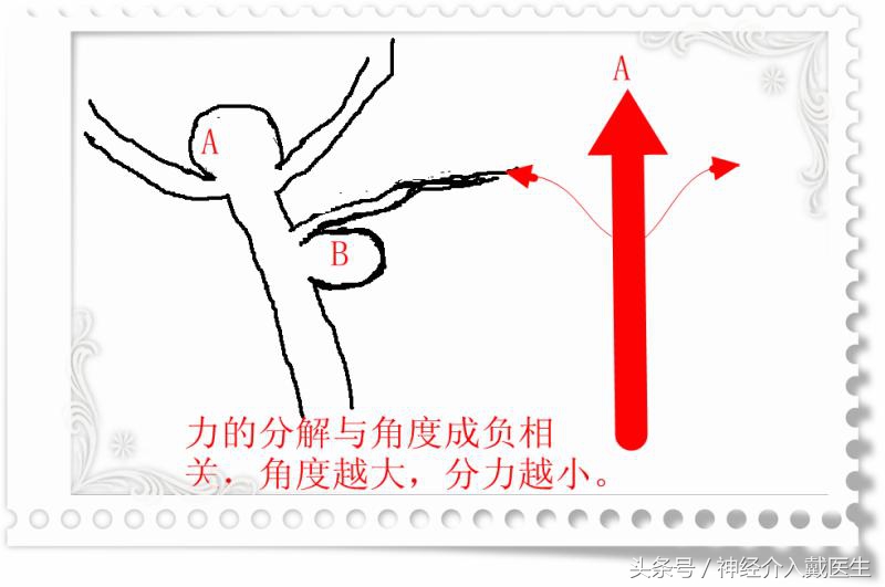关于动脉瘤的治疗有几种方法,颅内动脉瘤的最新指南和共识