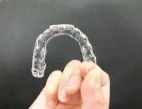 隐形牙套免费试戴珠海,福建免费隐形牙套