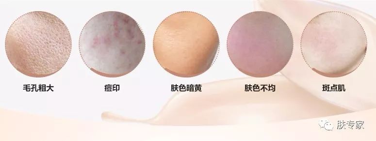 瑕疵皮肤全妆教程,只需三步完美底妆