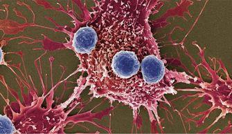 啪啪打脸！癌症免疫疗法遭遇重创！