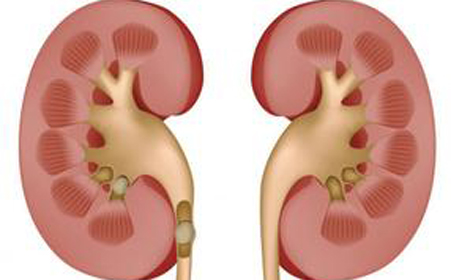 脾虚肾虚肝郁气虚血虚怎么治疗,肾虚脾虚最有效方法