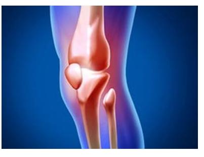 膝盖骨质增生的克星草药,膝关节骨质增生的克星