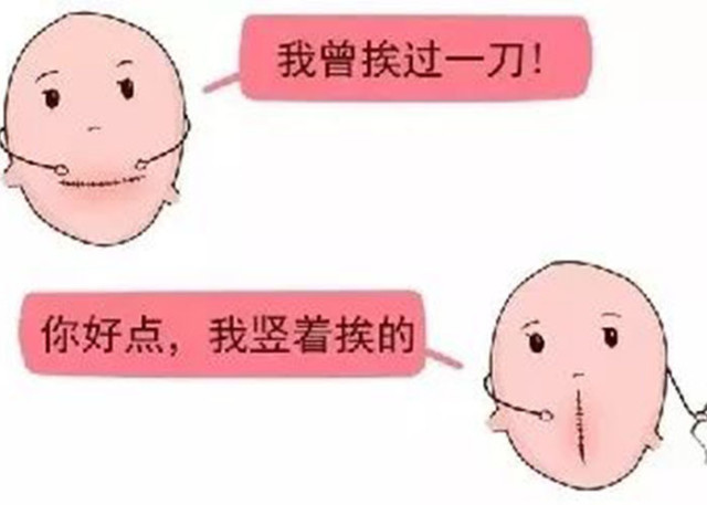 一次剖腹产二胎能顺产嘛,一次剖宫产和二次区别